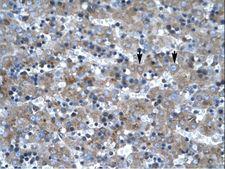 LHX6 Antibody - LHX6 antibody ARP32553_T100-NP_055183-LHX6 (LIM homeobox 6) Antibody was used in IHC to stain formalin-fixed, paraffin-embedded human liver.  This image was taken for the unconjugated form of this product. Other forms have not been tested.