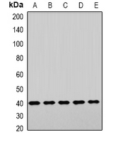 LHX6 Antibody - Western blot analysis of LHX6 expression in HepG2 (A); NIH3T3 (B); mouse brain (C); mouse liver (D); rat heart (E) whole cell lysates.