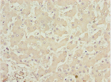 LHX6 Antibody - Immunohistochemistry of paraffin-embedded human liver tissue at dilution 1:100