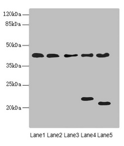LHX6 Antibody - Western blot All Lanes:LHX6 antibody at 3.02ug/ml Lane 1 : HepG-2 whole cell lysate Lane 2 : U87 whole cell lysate Lane 3 : NIH/3T3 whole cell lysate Lane 4 : Mouse brain tissue Lane 5 : Mouse liver tissue Secondary Goat polyclonal to Rabbit IgG at 1/10000 dilution Predicted band size: 41,39,44,42,20 kDa Observed band size: 40,22,20 kDa