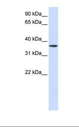 LHX8 Antibody - Fetal liver lysate. Antibody concentration: 1.0 ug/ml. Gel concentration: 12%.  This image was taken for the unconjugated form of this product. Other forms have not been tested.