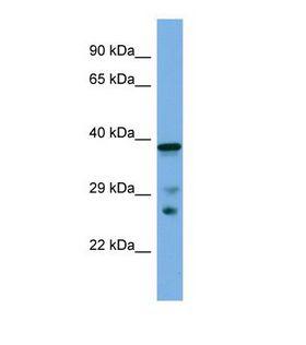 LHX8 Antibody - Western blot of Mouse Small Intestine. Lhx8 antibody dilution 1.0 ug/ml.  This image was taken for the unconjugated form of this product. Other forms have not been tested.