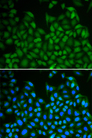 LHX8 Antibody - Immunofluorescence analysis of A549 cells.