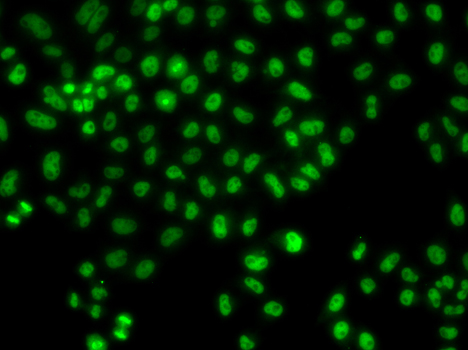 LHX8 Antibody - Immunofluorescence analysis of HeLa cells.