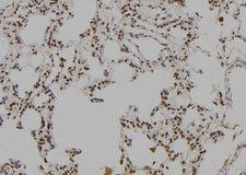 LHX8 Antibody - 1:100 staining rat lung tissue by IHC-P. The sample was formaldehyde fixed and a heat mediated antigen retrieval step in citrate buffer was performed. The sample was then blocked and incubated with the antibody for 1.5 hours at 22°C. An HRP conjugated goat anti-rabbit antibody was used as the secondary.