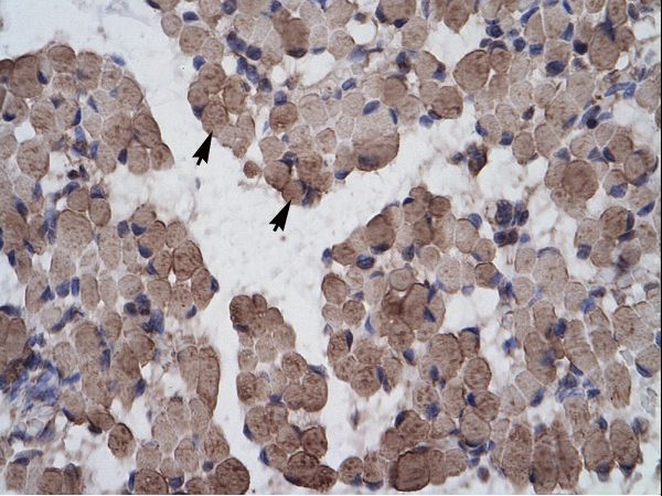 LHX9 Antibody - LHX9 antibody ARP35965_T100-NP_064589-LHX9 (LIM homeobox 9) Antibody was used in IHC to stain formalin-fixed, paraffin-embedded human muscle.  This image was taken for the unconjugated form of this product. Other forms have not been tested.
