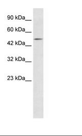 LHX9 Antibody - Jurkat Cell Lysate.  This image was taken for the unconjugated form of this product. Other forms have not been tested.
