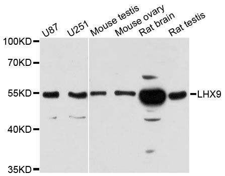 LHX9 Antibody - Western blot analysis of extracts of various cell lines, using LHX9 antibody at 1:3000 dilution. The secondary antibody used was an HRP Goat Anti-Rabbit IgG (H+L) at 1:10000 dilution. Lysates were loaded 25ug per lane and 3% nonfat dry milk in TBST was used for blocking. An ECL Kit was used for detection and the exposure time was 90s.