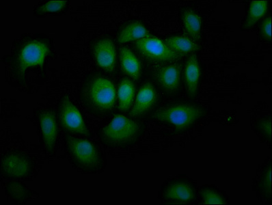 LI2 / Abca12 Antibody - Immunofluorescence staining of A549 cells at a dilution of 1:166, counter-stained with DAPI. The cells were fixed in 4% formaldehyde, permeabilized using 0.2% Triton X-100 and blocked in 10% normal Goat Serum. The cells were then incubated with the antibody overnight at 4 °C.The secondary antibody was Alexa Fluor 488-congugated AffiniPure Goat Anti-Rabbit IgG (H+L) .