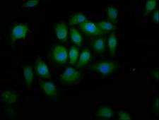 LI2 / Abca12 Antibody - Immunofluorescence staining of A549 cells at a dilution of 1:166, counter-stained with DAPI. The cells were fixed in 4% formaldehyde, permeabilized using 0.2% Triton X-100 and blocked in 10% normal Goat Serum. The cells were then incubated with the antibody overnight at 4 °C.The secondary antibody was Alexa Fluor 488-congugated AffiniPure Goat Anti-Rabbit IgG (H+L) .