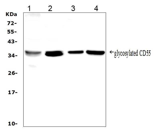 LIF Antibody - Western blot analysis of LIF using anti-LIF antibody. Electrophoresis was performed on a 5-20% SDS-PAGE gel at 70V (Stacking gel) / 90V (Resolving gel) for 2-3 hours. The sample well of each lane was loaded with 50ug of sample under reducing conditions. Lane 1: human Hela whole cell lysates, Lane 2: human placenta tissue lysates, Lane 3: human A431whole cell lysates, Lane 4: human A549 whole cell lysates. After Electrophoresis, proteins were transferred to a Nitrocellulose membrane at 150mA for 50-90 minutes. Blocked the membrane with 5% Non-fat Milk/ TBS for 1.5 hour at RT. The membrane was incubated with rabbit anti-LIF antigen affinity purified polyclonal antibody at 0.5 µg/mL overnight at 4°C, then washed with TBS-0.1% Tween 3 times with 5 minutes each and probed with a goat anti-rabbit IgG-HRP secondary antibody at a dilution of 1:10000 for 1.5 hour at RT. The signal is developed using an Enhanced Chemiluminescent detection (ECL) kit with Tanon 5200 system. A specific band was detected for LIF at approximately 36KD. The expected band size for LIF is at 22KD.