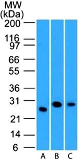 LIF Antibody - Western Blot: LIF Antibody (39N7D10) - WB validation of LIF antibody (clone 39N7D10) on (A) full-length recombinant Lif protein, (B) mouse spleen lysate and human spleen lysate. 3 ug/ml concentration of primary antibody, Goat anti-rat Ig HRP secondary antibody and PicoTect ECL substrate solution were used for this assay.  This image was taken for the unconjugated form of this product. Other forms have not been tested.