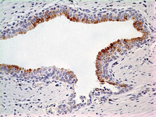 LIF Antibody - Immunohistochemistry-Paraffin: LIF Antibody (39N7D10) - IHC analysis of formalin-fixed paraffin-embedded tissue section of normal human prostate using 5 ug/ml concentration of LIF antibody (clone 39N7D10). Cell surface/membrane- cytoplasmic immunopositivity of LIF was observed specifically in the epithelial cells of prostate alveolar glands whereas the surrounding fibromuscular stroma cells did not develop any staining.  This image was taken for the unconjugated form of this product. Other forms have not been tested.