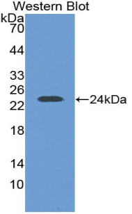 LIF Antibody - Western blot of recombinant LIF.