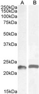 LIF Antibody - LIF antibody (0.5µg/ml) staining of Mouse (A) and (1ug/ml) Rat (B) Colon lysate (35µg protein in RIPA buffer). Detected by chemiluminescence.