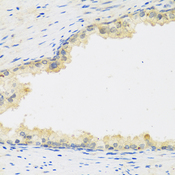 LIF Antibody - Immunohistochemistry of formalin-fixed paraffin-embedded (FFPE) human prostate using LIF antibody at dilution of 1:100 (40x magnification).