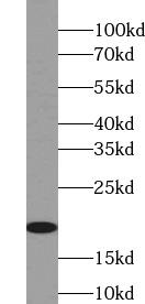 LIF Antibody - Jurkat cells were subjected to SDS PAGE followed by western blot with LIF antibody at dilution of 1:500