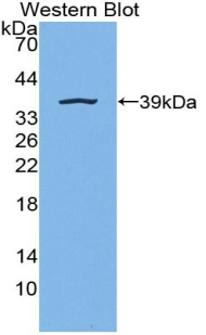 LIG1 / DNA Ligase 1 Antibody - Western blot of recombinant LIG1 / DNA Ligase 1.