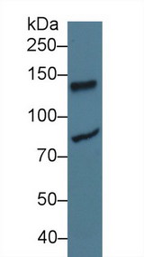 LIG1 / DNA Ligase 1 Antibody - Western Blot; Sample: Human Jurkat cell lysate; Primary Ab: 3µg/ml Rabbit Anti-Rat LIG1 Antibody Second Ab: 0.2µg/mL HRP-Linked Caprine Anti-Rabbit IgG Polyclonal Antibody