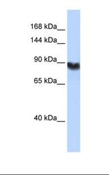 LIG1 / DNA Ligase 1 Antibody - HepG2 cell lysate. Antibody concentration: 1.0 ug/ml. Gel concentration: 6-18%.  This image was taken for the unconjugated form of this product. Other forms have not been tested.