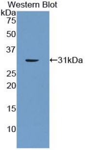LIG1 / DNA Ligase 1 Antibody - Western blot of recombinant LIG1 / DNA Ligase 1.  This image was taken for the unconjugated form of this product. Other forms have not been tested.