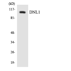 LIG1 / DNA Ligase 1 Antibody - Western blot analysis of the lysates from HepG2 cells using DNL1 antibody.