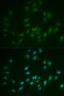 LIG1 / DNA Ligase 1 Antibody - Immunofluorescence analysis of MCF7 cells.