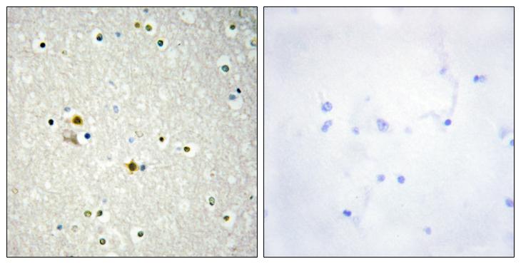 LIG1 / DNA Ligase 1 Antibody - Peptide - + Immunohistochemistry analysis of paraffin-embedded human brain tissue using DNL1 antibody.