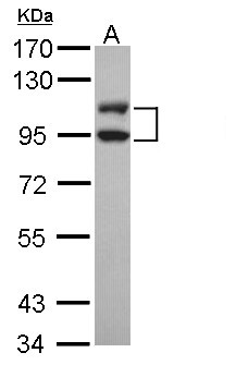 LIG3 / DNA Ligase III Antibody - Sample (30 ug of whole cell lysate). A: Hep G2 . 7.5% SDS PAGE. DNA Ligase III antibody diluted at 1:1000.
