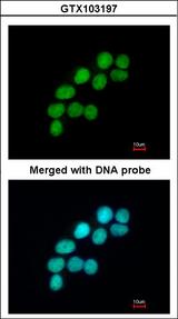 LIG3 / DNA Ligase III Antibody - Immunofluorescence of paraformaldehyde-fixed A431 using DNA ligase 3 antibody at 1:200 dilution.