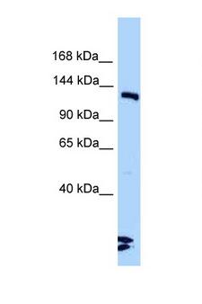LIG3 / DNA Ligase III Antibody - LIG3 antibody Western blot of Mouse Heart lysate. Antibody concentration 1 ug/ml.  This image was taken for the unconjugated form of this product. Other forms have not been tested.