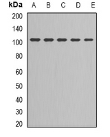 LIG3 / DNA Ligase III Antibody - Western blot analysis of DNA Ligase 3 expression in Jurkat (A); NIH3T3 (B); MCF7 (C); PC3 (D); HeLa (E) whole cell lysates.