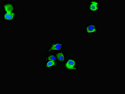 LIG3 / DNA Ligase III Antibody - Immunofluorescent analysis of HeLa cells diluted at 1:100 and Alexa Fluor 488-congugated AffiniPure Goat Anti-Rabbit IgG(H+L)