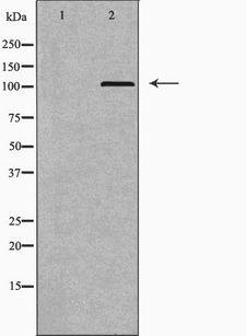 LIG3 / DNA Ligase III Antibody - Western blot analysis of extracts of testis using LIG3 antibody. The lane on the left is treated with the antigen-specific peptide.