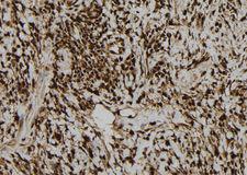 LIG3 / DNA Ligase III Antibody - 1:100 staining human gastric tissue by IHC-P. The sample was formaldehyde fixed and a heat mediated antigen retrieval step in citrate buffer was performed. The sample was then blocked and incubated with the antibody for 1.5 hours at 22°C. An HRP conjugated goat anti-rabbit antibody was used as the secondary.
