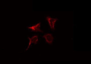 LIG3 / DNA Ligase III Antibody - Staining K562 cells by IF/ICC. The samples were fixed with PFA and permeabilized in 0.1% Triton X-100, then blocked in 10% serum for 45 min at 25°C. The primary antibody was diluted at 1:200 and incubated with the sample for 1 hour at 37°C. An Alexa Fluor 594 conjugated goat anti-rabbit IgG (H+L) Ab, diluted at 1/600, was used as the secondary antibody.