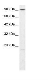 LIG4 / DNA Ligase IV Antibody - HepG2 Cell Lysate.  This image was taken for the unconjugated form of this product. Other forms have not been tested.