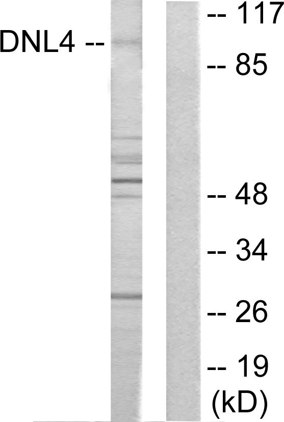 LIG4 / DNA Ligase IV Antibody - Western blot analysis of lysates from Jurkat cells, using DNL4 Antibody. The lane on the right is blocked with the synthesized peptide.