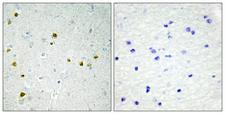 LIG4 / DNA Ligase IV Antibody - Peptide - + Immunohistochemistry analysis of paraffin-embedded human brain tissue using DNA Ligase 4 antibody.