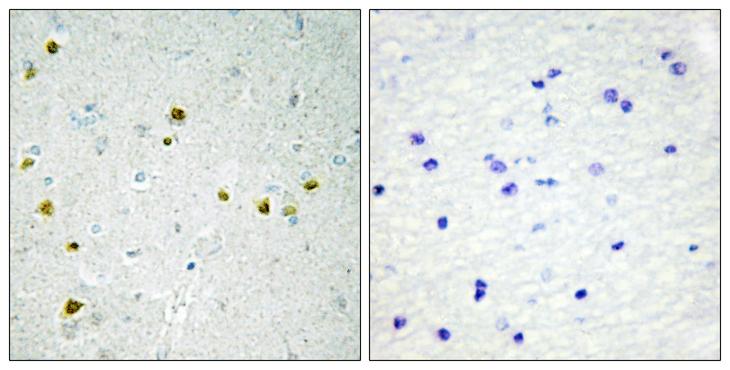 LIG4 / DNA Ligase IV Antibody - Peptide - + Immunohistochemistry analysis of paraffin-embedded human brain tissue using DNA Ligase 4 antibody.