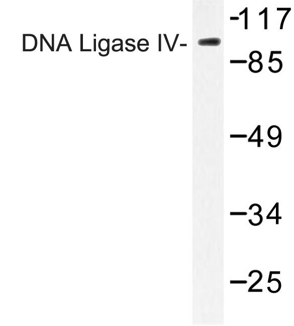 LIG4 / DNA Ligase IV Antibody - Western blot of DNA Ligase IV (G619) pAb in extracts from Jurkat cells.