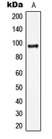 LIG4 / DNA Ligase IV Antibody - Western blot analysis of DNA Ligase 4 expression in HepG2 (A) whole cell lysates.