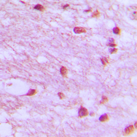 LIG4 / DNA Ligase IV Antibody - Immunohistochemical analysis of DNA Ligase 4 staining in human brain formalin fixed paraffin embedded tissue section. The section was pre-treated using heat mediated antigen retrieval with sodium citrate buffer (pH 6.0). The section was then incubated with the antibody at room temperature and detected using an HRP conjugated compact polymer system. DAB was used as the chromogen. The section was then counterstained with hematoxylin and mounted with DPX.