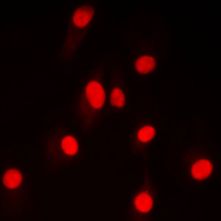 LIG4 / DNA Ligase IV Antibody - Immunofluorescent analysis of DNA Ligase 4 staining in HepG2 cells. Formalin-fixed cells were permeabilized with 0.1% Triton X-100 in TBS for 5-10 minutes and blocked with 3% BSA-PBS for 30 minutes at room temperature. Cells were probed with the primary antibody in 3% BSA-PBS and incubated overnight at 4 C in a humidified chamber. Cells were washed with PBST and incubated with a DyLight 594-conjugated secondary antibody (red) in PBS at room temperature in the dark. DAPI was used to stain the cell nuclei (blue).