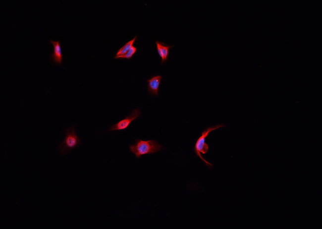 LIG4 / DNA Ligase IV Antibody - Staining HepG2 cells by IF/ICC. The samples were fixed with PFA and permeabilized in 0.1% Triton X-100, then blocked in 10% serum for 45 min at 25°C. The primary antibody was diluted at 1:200 and incubated with the sample for 1 hour at 37°C. An Alexa Fluor 594 conjugated goat anti-rabbit IgG (H+L) antibody, diluted at 1/600, was used as secondary antibody.