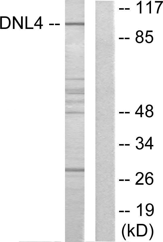 LIG4 / DNA Ligase IV Antibody - Western blot analysis of extracts from Jurkat cells, using DNL4 antibody.