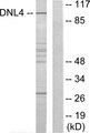 LIG4 / DNA Ligase IV Antibody - Western blot analysis of extracts from Jurkat cells, using DNL4 antibody.