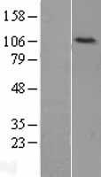 LIG4 / DNA Ligase IV Protein - Western validation with an anti-DDK antibody * L: Control HEK293 lysate R: Over-expression lysate