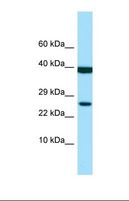 LILRA1 / LIR6 Antibody - Western blot of Human MDA-MB-435S. LILRA1 antibody dilution 1.0 ug/ml.  This image was taken for the unconjugated form of this product. Other forms have not been tested.