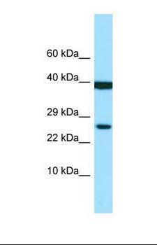 LILRA1 / LIR6 Antibody - Western blot of Human MDA-MB-435S. LILRA1 antibody dilution 1.0 ug/ml.  This image was taken for the unconjugated form of this product. Other forms have not been tested.